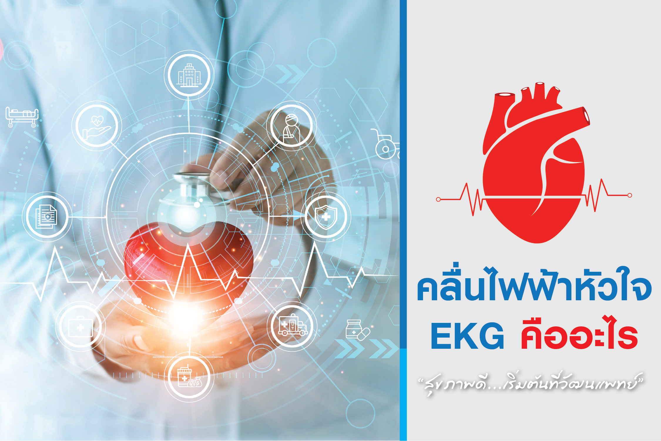 EKG