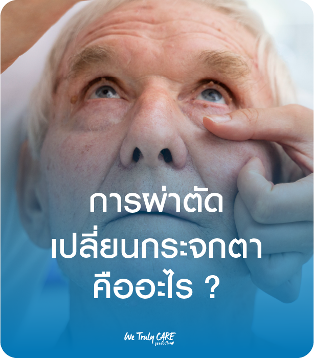 การเปลี่ยน..กระจกตา