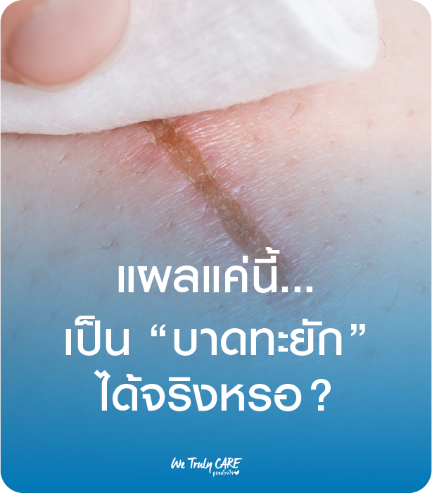 แผลแค่นี้มีโอกาสเป็นบาดทะยัก ?