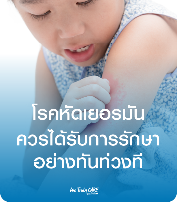 รู้จักโรคหัดเยอรมัน…โรคที่ไม่อันตรายสำหรับคุณแม่ แต่รุนแรงต่อลูกน้อย