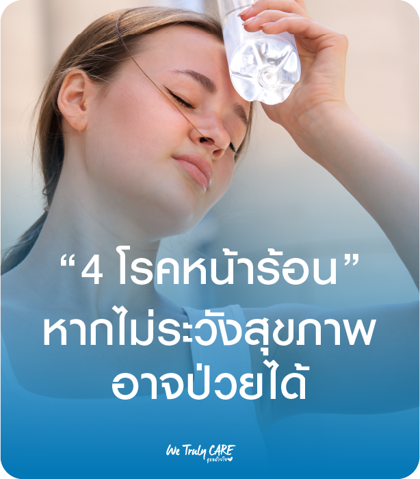 4 โรคหน้าร้อน ที่ควรระวัง