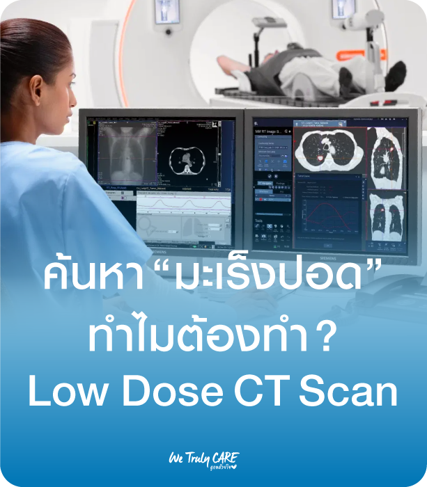 ค้นหามะเร็งปอด ทำไมต้องทำ? Low Dose CT Scan