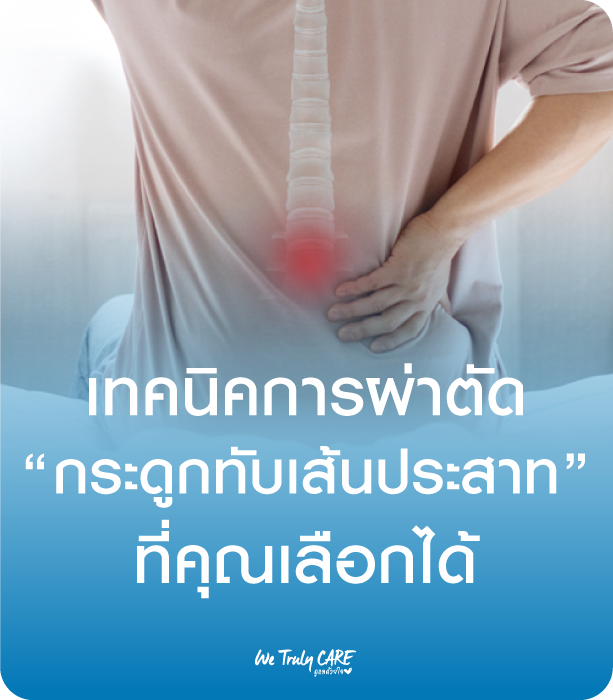 เทคนิคการผ่าตัดกระดูกทับเส้นประสาท