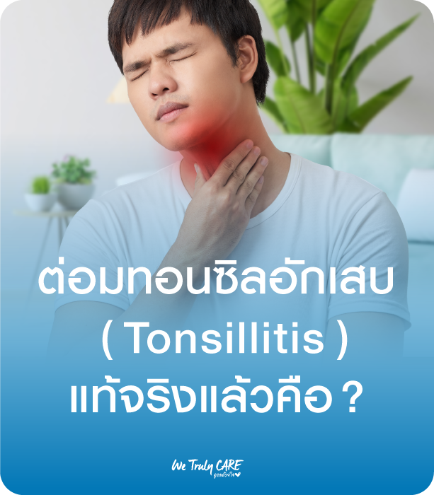 ต่อมทอนซิลอักเสบ แท้จริงแล้วคืออะไร ?