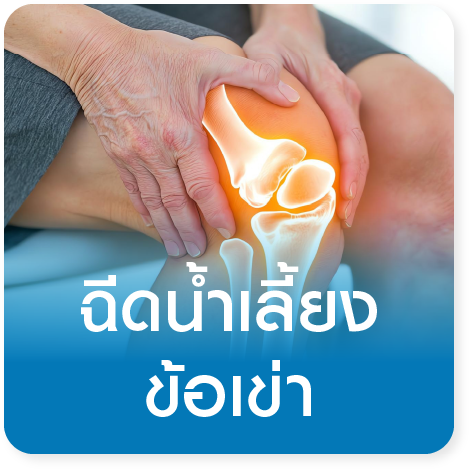 แพ็กเกจฉีดน้ำหล่อเลี้ยงข้อเข่าเสื่อม Hyaluronic Acid
