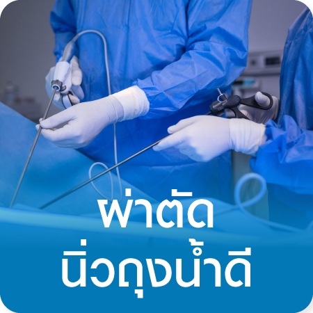 แพ็กเกจผ่าตัดนิ่วในถุงน้ำดี Laparoscopic Cholecystectomy