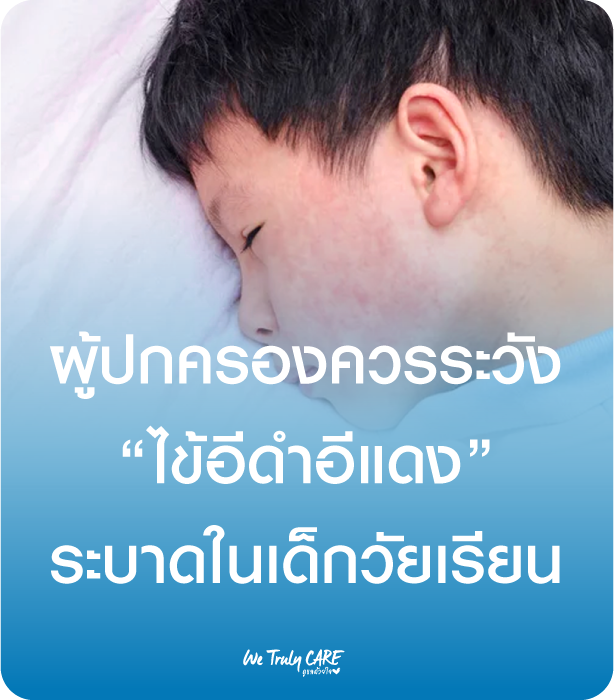 ผู้ปกครองควรระวัง ไข้อีดำอีแดง ระบาดในเด็กวัยเรียน