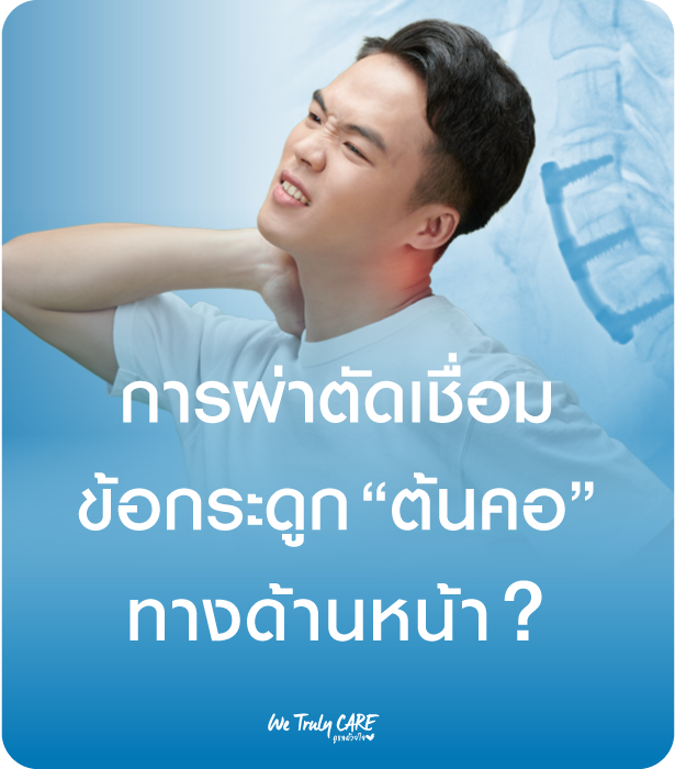 การผ่าตัดเชื่อมข้อกระดูกต้นคอทางด้านหน้า ACDF  