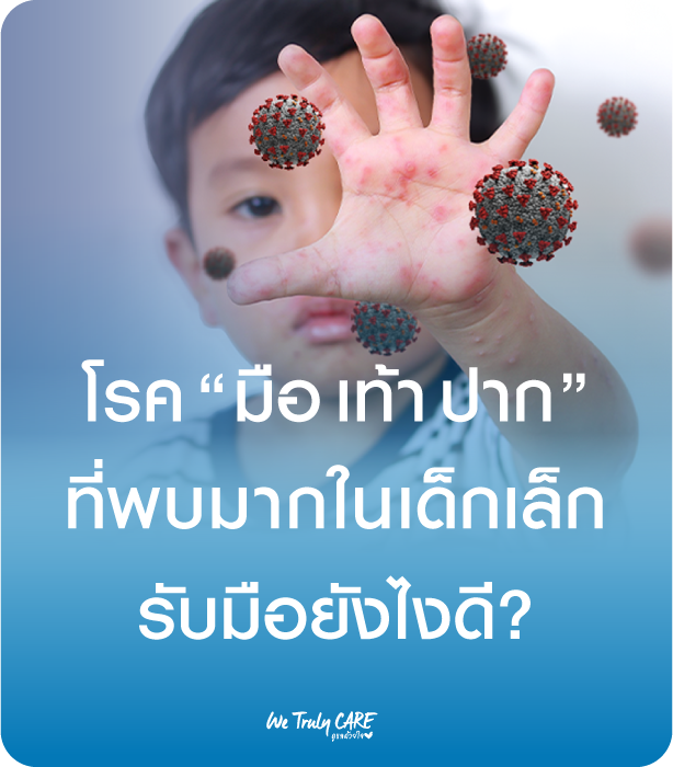 โรค มือ เท้า ปาก พบมากในเด็กเล็ก รับมือยังไงดี?