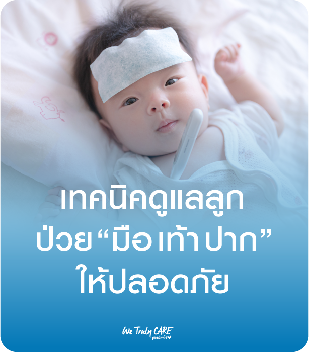 เทคนิคดูแลลูกเมื่อป่วย มือ เท้า ปาก อย่างไรให้ปลอดภัย