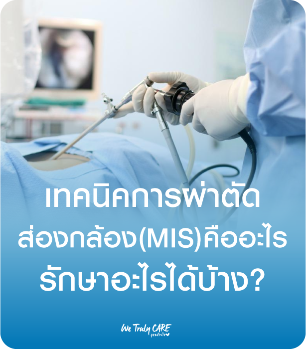 เทคนิคการผ่าตัด ส่องกล้อง(MIS)คืออะไร รักษาอะไรได้บ้าง?
