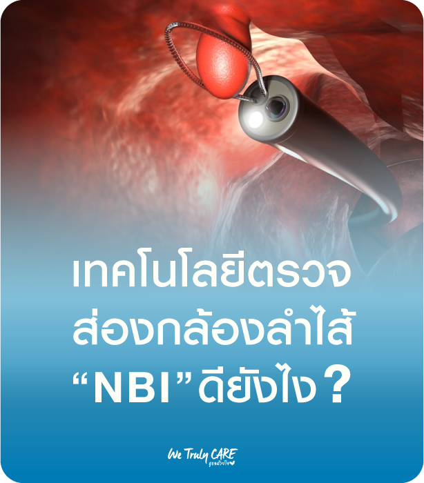 เทคโนโลยีตรวจส่องกล้องลำไส้ NBI ดียังไง